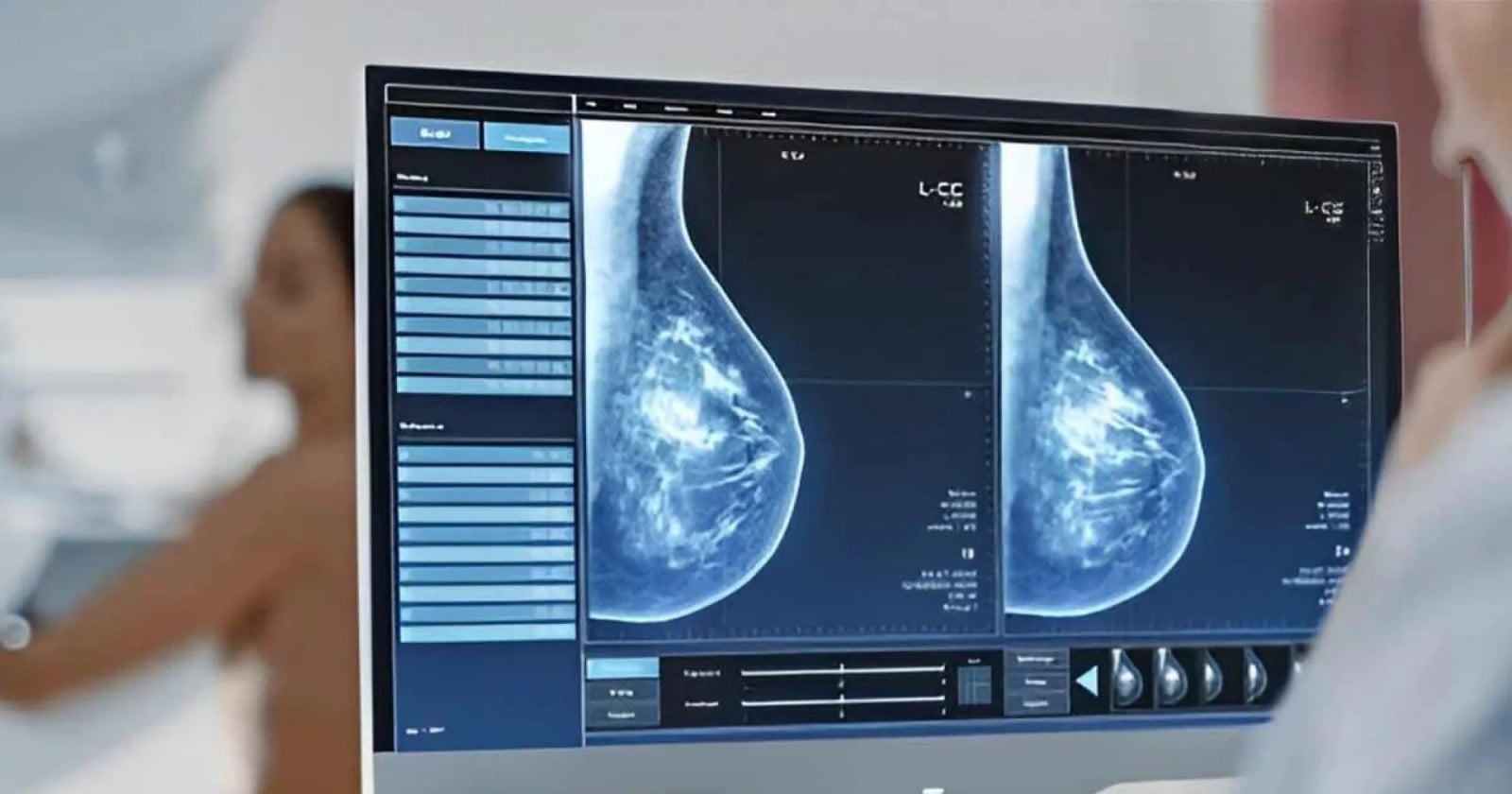 Mujeres esperan su turno para la mamografía en la sala de un hospital de Neuquén
